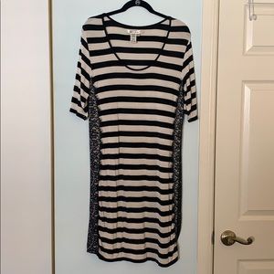 Stripped Dress with Lace Detail